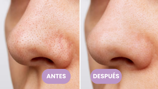 Limpiador peeling facial